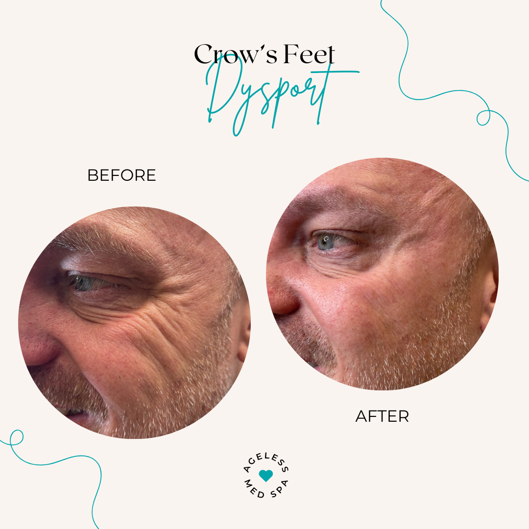 Dana Crow's Feet (1)