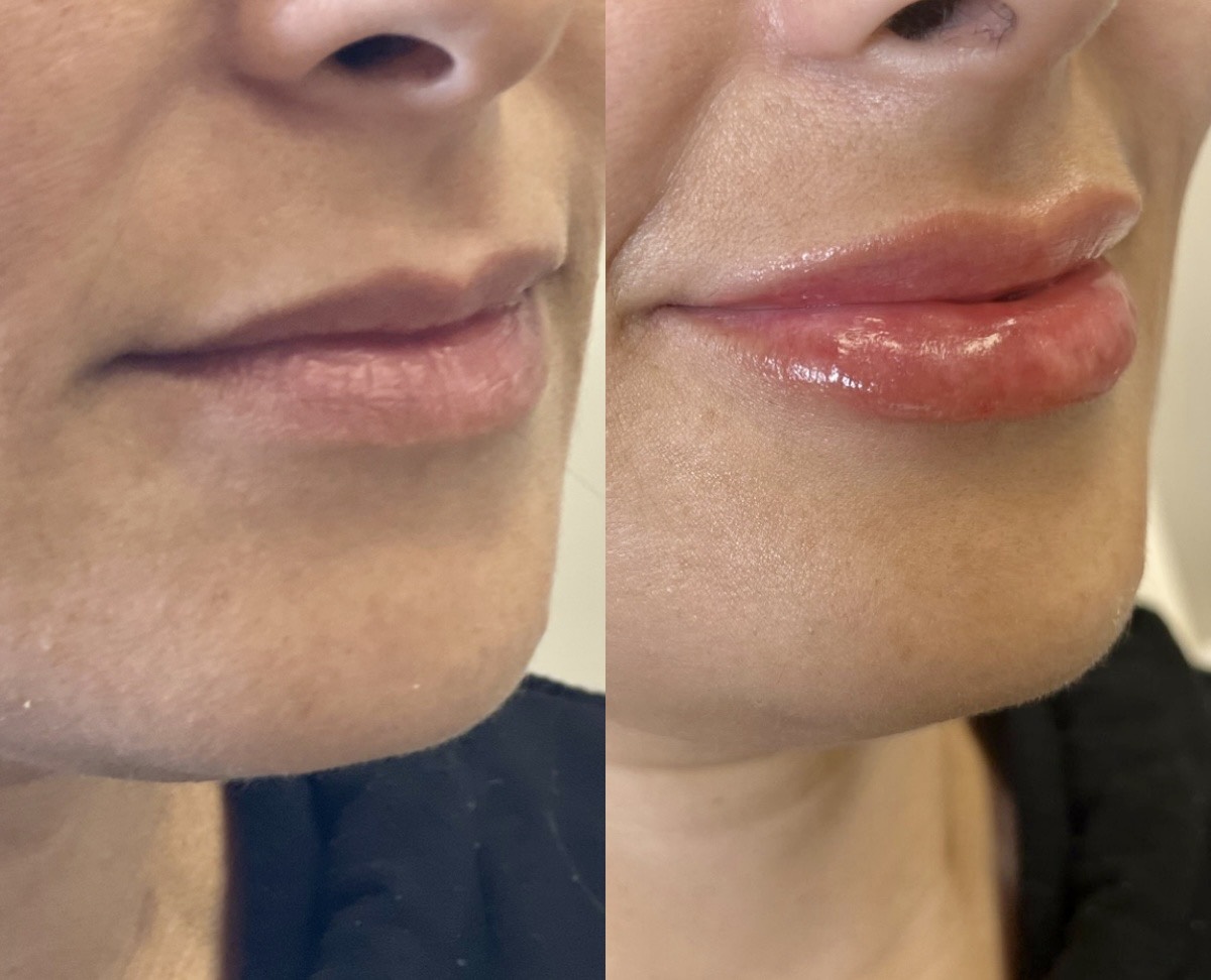 Processed with MOLDIV