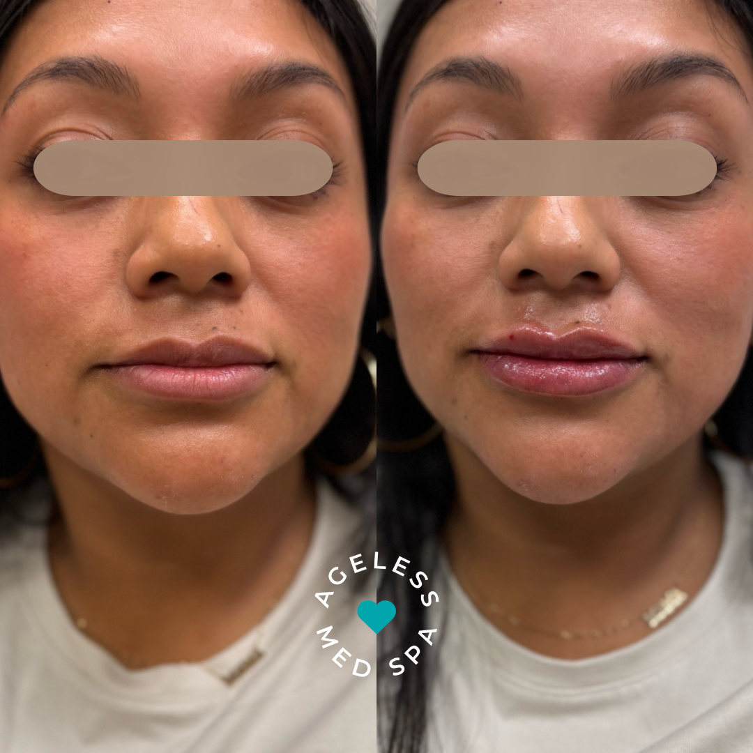 Maria V lips x2 front