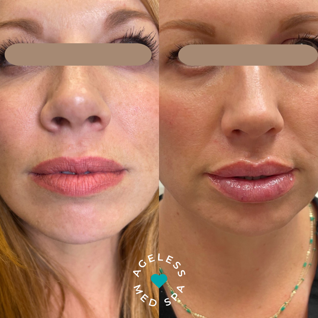 Maria_Lauren lips (2)