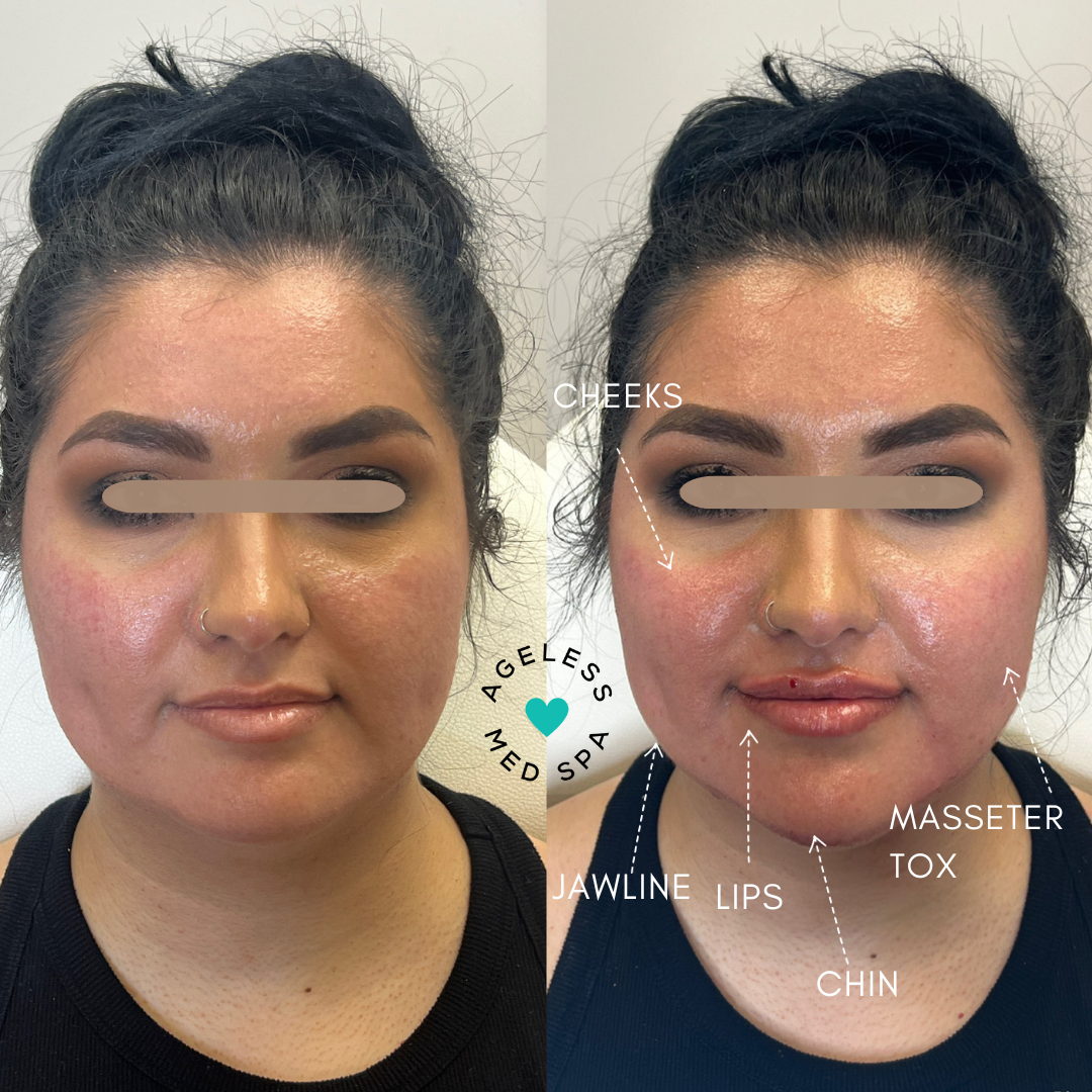 Mickela Facial Balancing